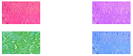 foot-scrubber-colors.jpg