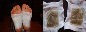 Before-and-After-images-of-the-detox-foot-pads-by-idivalicious-on-Flickr.jpg