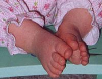 Happy baby girl feet!