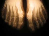 feet-xray-by-kilokilo.jpg