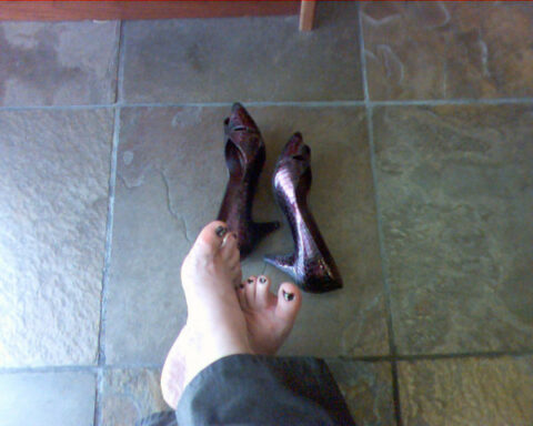 Foot Corn Treatment: 3 Natural Cures For Corns On Your Feet