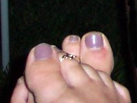 A photo of painted toenails... and feet in need of a pedicure!