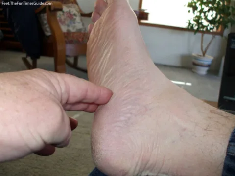 The heel pain I was experiencing was indeed Plantar Faciitis. photo by Curtis at TheFunTimesGuide.com