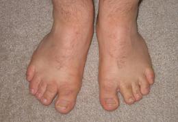 A pair of yabba dabba doo feet.