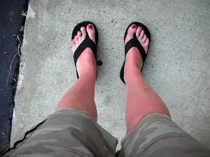 sunburned-feet-in-flip-flops-by-brandi666.jpg